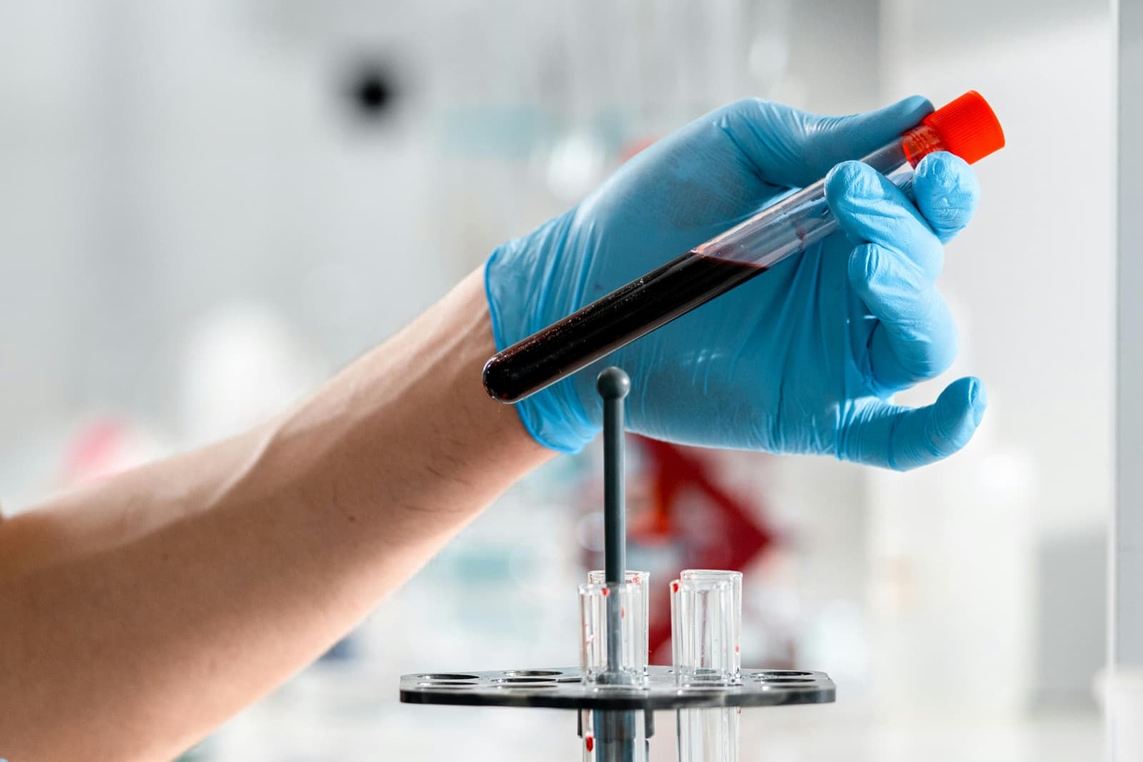 Gloved hand holding a blood draw tube in a clinical lab — the full hormone panel evaluated together at Castellano Health Institute