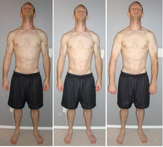 Patient J.G. of Anaheim — earlier recovery progression after muscle-wasting atrophy